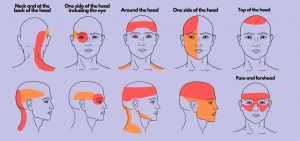 Tipos de cefalea 1